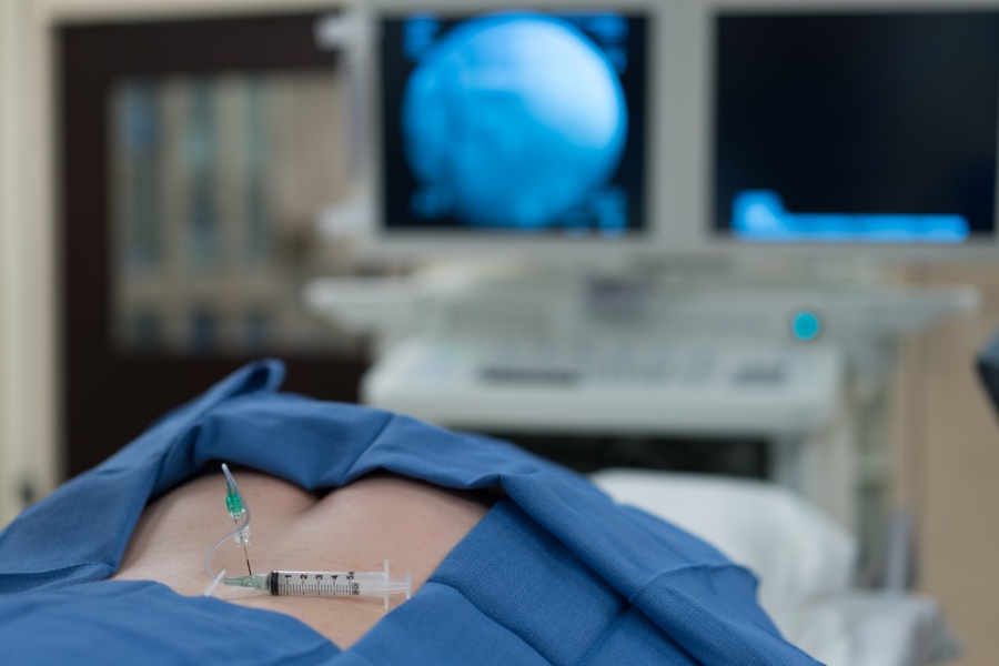 Cervical and Lumbar Epidural Injections        